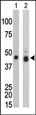 Anti-CKB Rabbit Polyclonal Antibody (APC (Allophycocyanin))