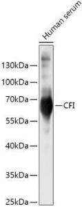 Anti-Factor I / CFI Rabbit Polyclonal Antibody