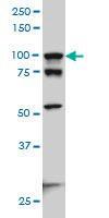 Anti-ACTN4 Mouse Monoclonal Antibody [clone: 4D10]