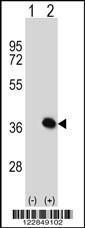 Anti-ARPC1B Rabbit Polyclonal Antibody (HRP (Horseradish Peroxidase))