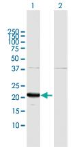 Anti-GLO1 Rabbit Polyclonal Antibody