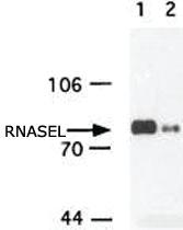 Anti-RNASEL Mouse Monoclonal Antibody [clone: 2E9]