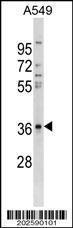 Anti-CTGF Mouse Monoclonal Antibody (FITC (Fluorescein Isothiocyanate)) [clone: 558CT34.4.4]