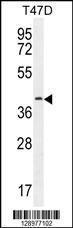 Anti-FBLN7 Rabbit Polyclonal Antibody (HRP (Horseradish Peroxidase))