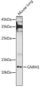 Western blot analysis of extracts of Mouse lung, using Anti-GnRH Antibody (A9729) at 1:1,000 dilution. The secondary antibody was Goat Anti-Rabbit IgG H&L Antibody (HRP) at 1:10,000 dilution.