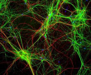 Mixed neuron/glia cultures stained with Anti-MAP2 Antibody (green) and Anti-NF-H Antibody (A85336 / red). Since the NF-H protein is largely expressed in neuronal axons, while the MAP2 is only found in neuronal dendrites and perikarya, there is little overlap between these two staining patterns.