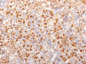 Anti-ACTH Mouse Monoclonal Antibody [clone: 2F6]