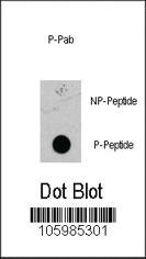 Anti-MAP2K1 Rabbit Polyclonal Antibody