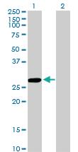 Anti-CCBL1 Mouse Monoclonal Antibody [clone: 1B12]