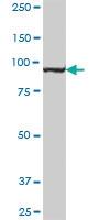 Anti-MTHFD1 Mouse Polyclonal Antibody