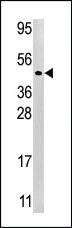 Anti-MAP2K1 Rabbit Polyclonal Antibody