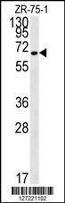 Anti-N4BP3 Rabbit Polyclonal Antibody (APC (Allophycocyanin))