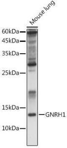 Western blot analysis of extracts of Rat kidney, using Anti-GnRH Antibody (A9729) at 1:1,000 dilution. The secondary antibody was Goat Anti-Rabbit IgG H&L Antibody (HRP) at 1:10,000 dilution.