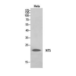 Western blot analysis of HeLa, HepG2 cells using Anti-NTS Antibody