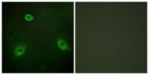 Immunofluorescence analysis of HepG2 cells using Anti-TM16G Antibody. The right hand panel represents a negative control, where the Antibody was pre-incubated with the immunising peptide