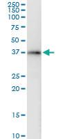 Anti-PRKAG2 Polyclonal Antibody Pair