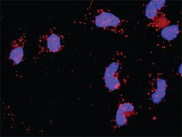 Anti-BIRC2 + TRAF2 Antibody Pair