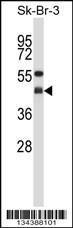 Anti-GNAI2 Rabbit Polyclonal Antibody (FITC (Fluorescein Isothiocyanate))