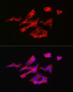 Immunofluorescence analysis of SH-SY5Y cells using Anti-GnRH Antibody (A9729) at a dilution of 1:200 (40x lens). DAPI was used to stain the cell nuclei (blue).