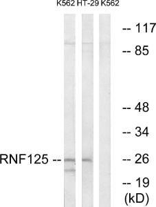 Western blot analysis of lysates from K562 and HT-29 cells using Anti-RNF125 Antibody The right hand lane represents a negative control, where the antibody is blocked by the immunising peptide