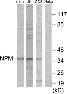 Western blot analysis of lysates from HeLa, Jurkat, and COS7 cells using Anti-NPM Antibody The right hand lane represents a negative control, where the antibody is blocked by the immunising peptide