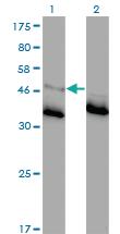 Anti-GLRA1 Mouse Monoclonal Antibody [clone: 2E6]