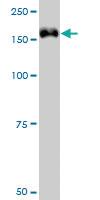 Anti-TRIM33 Mouse Monoclonal Antibody [clone: 6D1]