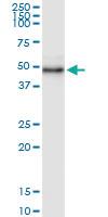 Anti-WDR19 Polyclonal Antibody Pair