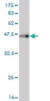 Anti-ABCF2 Mouse Monoclonal Antibody [clone: 1D11]