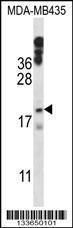 Anti-HIST1H1E Rabbit Polyclonal Antibody (APC (Allophycocyanin))