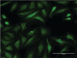 Anti-CCBL1 Mouse Monoclonal Antibody [clone: 1B12]