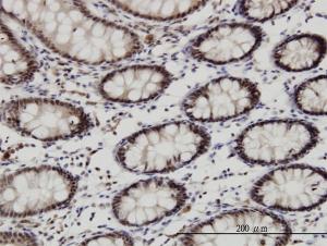 Anti-GSC Mouse Monoclonal Antibody [clone: 4H7]