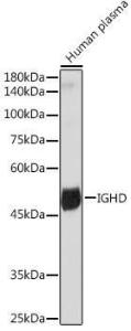 Western blot analysis of extracts of Human plasma, using Anti-IgD Antibody [ARC2240] (A305388) at 1:1,000 dilution