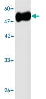 Anti-Legionella pneumophila omp28 Mouse Monoclonal Antibody [clone: 1f35]