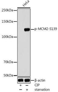 Western blot analysis of extracts of HeLa cells, using Anti-MCM2 (phospho Ser139) Antibody (A309197) at 1:1000 dilution