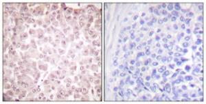 Antibody anti-RCBTB1 100 µg