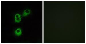 Immunofluorescence analysis of MCF7 cells using Anti-OR5M1 Antibody. The right hand panel represents a negative control, where the antibody was pre-incubated with the immunising peptide