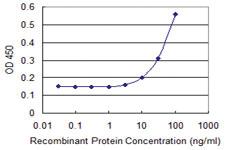 Anti-CCBL1 Mouse Monoclonal Antibody [clone: 1B12]