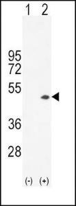 Anti-CKB Rabbit Polyclonal Antibody (HRP (Horseradish Peroxidase))