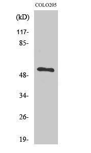 Western blot analysis of various cells using Anti-TIGD3 Antibody