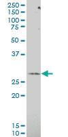 Anti-NNMT Mouse Polyclonal Antibody