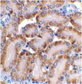 Anti-DFFB Rabbit Polyclonal Antibody