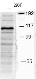 Anti-MIB1 Rabbit Polyclonal Antibody (PE (Phycoerythrin))