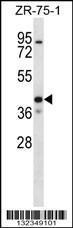 Anti-KCNK1 Rabbit Polyclonal Antibody (Biotin)