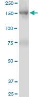 Anti-TRIM33 Mouse Monoclonal Antibody [clone: 6D1]