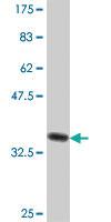 Anti-CDH17 Mouse Polyclonal Antibody