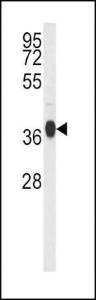 Anti-GNAO1 Rabbit Polyclonal Antibody (FITC (Fluorescein Isothiocyanate))