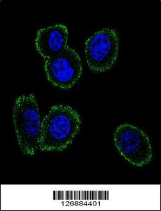 Anti-NMB Rabbit Polyclonal Antibody (HRP (Horseradish Peroxidase))