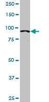 Anti-ACTN4 Mouse Monoclonal Antibody [clone: 4D10]