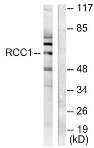 Antibody anti-RCBTB1 100 µg